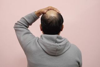 Vlasy začaly růst za 56 dní. Nové rostlinné sérum vzbuzuje celosvětovou pozornost - Novinky