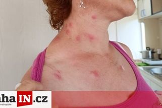 prahain.cz/zdravi/telo-jako-dukaz-zena-natocila-jak-dopadla-po-dvou-nocich-v-siklandu-13943.html?utm_source=www.seznam.cz&utm_medium=seznam_distribuce&utm_campaign=lide