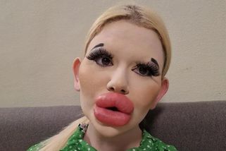 Může to být ještě horší? Kdysi krásné ženy se znetvořily plastikami: Největší rty na světě, prsa vážící více než 20 kg,...
