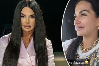 Odkládání zubaře se Zuzaně Plačkové nevyplatilo: Slovence vypadly její hollywoodské zoubky - Super.cz