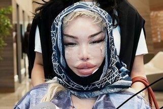 Královna plastik po dalším faceliftu varuje před zákroky: Jessica Alves věří, že napravil to, co předchozí zpackaly - Super.cz