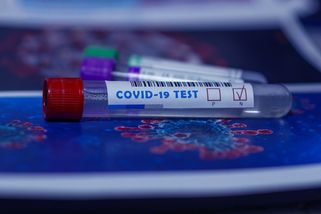Covid je na vzestupu. Průběh je závažnější než u chřipky, říká MUDr. Dlouhý - Česko Živě