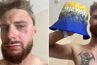 Poláka Jakuba v Ostravě zbili kvůli žlutomodrému kloboučku - Novinky