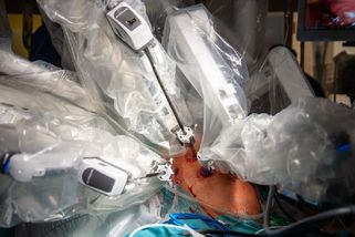 Za chronickými bolestmi břicha stál nádor slinivky. Ženě pomohla robotická operace - Novinky