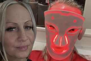 Botox odmítla, povadlou pleť vypnula za 170 korun. Proměna je tak výrazná, že se mě lidé ptají na plastiku, směje se - Super.cz