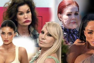 Celebrity, které ztratily svou tvář. Po plastikách jsou k nepoznání