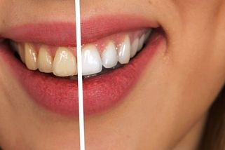 Dentální hygiena od VZP, dar - nedar - Médium.cz