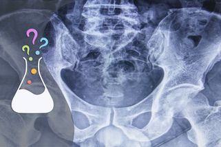 Co se děje s rentgenovým zářením v lidském těle? - Médium.cz