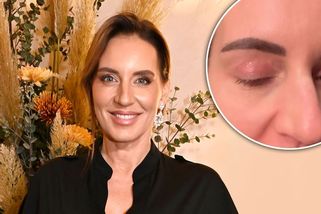 Na bolavý opar sperma do oka? Lucie Šlégrová přišla s bizarní babskou radou