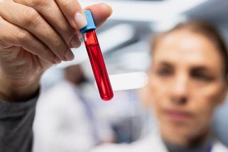 Fleky na nohou vše prozradily. Smrtící virus sílí, stovky nakažených lékařům unikají