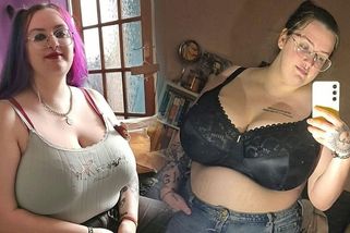 Obří prsa jí ničí život. Britka Anaise Hitchcock se rozhodla pro radikální řešení
