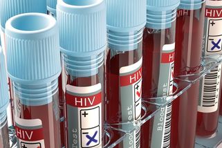 HIV se v Rusku začíná šířit i mimo rizikové skupiny - Novinky